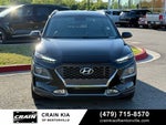 2018 Hyundai Kona Limited - SUNROOF / LEATHER